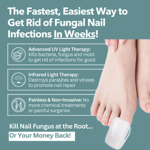 Elite™ - Nail Fungus Laser Device
