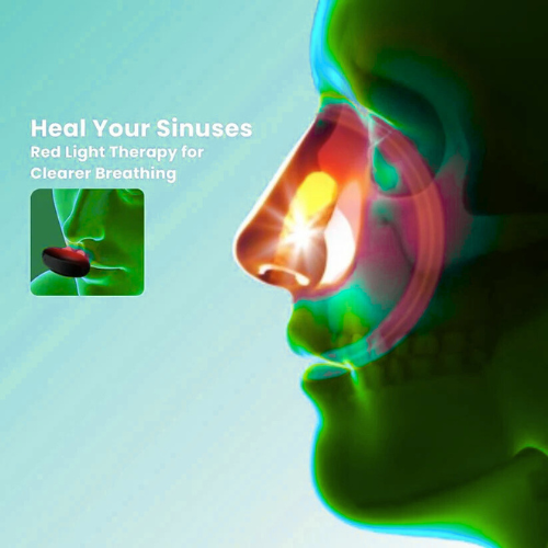 Elite™ - Comfortable Nasal Solution