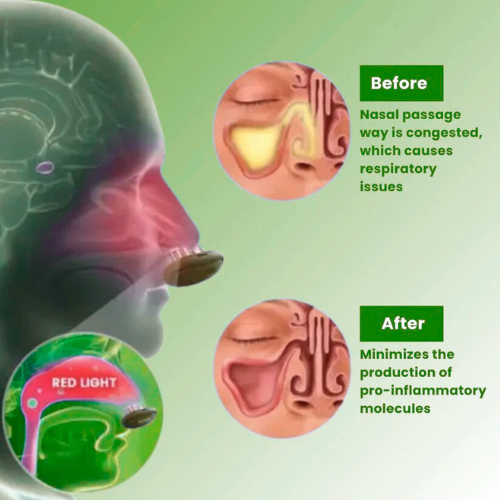 Elite™ - Comfortable Nasal Solution