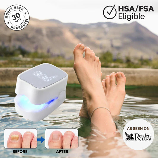 Elite™ - Nail Fungus Laser Device